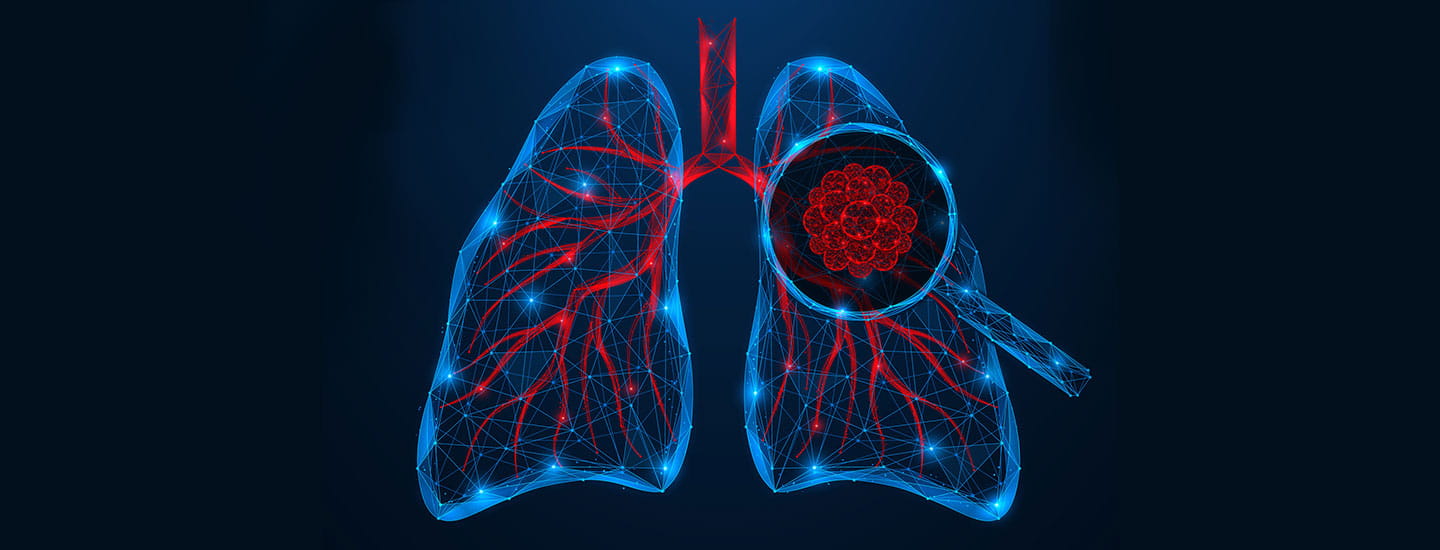 Lungs